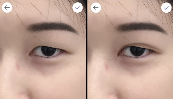 Asian shop double eyelid