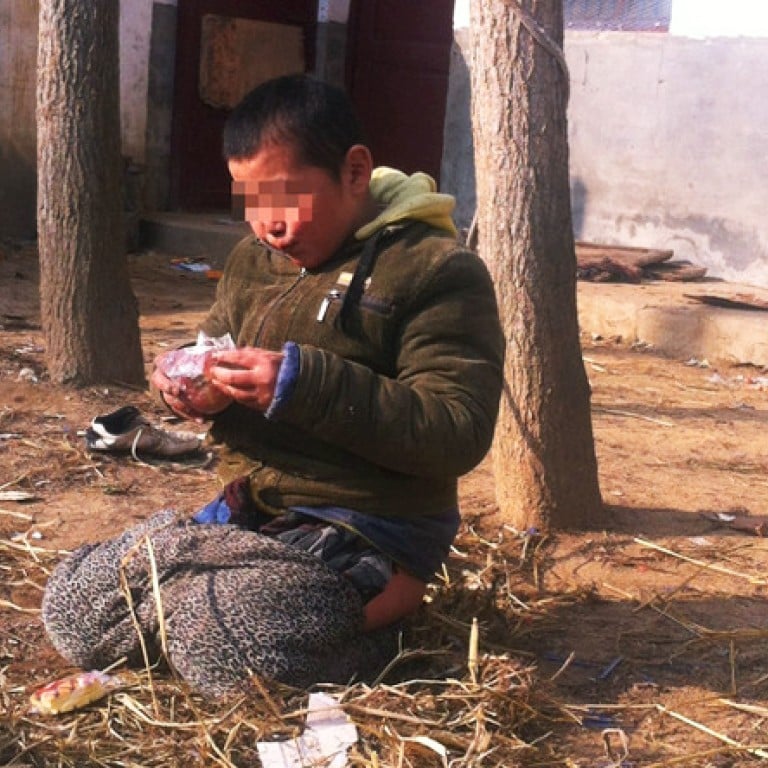 Chinese homeless shelter ties mentally ill boy to tree to 'stop him