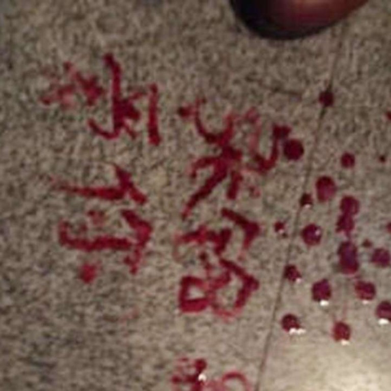 Police Called After Girl 19 Cuts Herself To Write Love Notes In