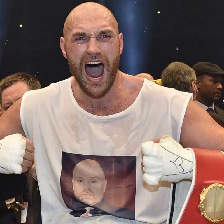 Tyson Fury Says ‘here To Stay’, Apparently Reversing Retirement Tweet ...