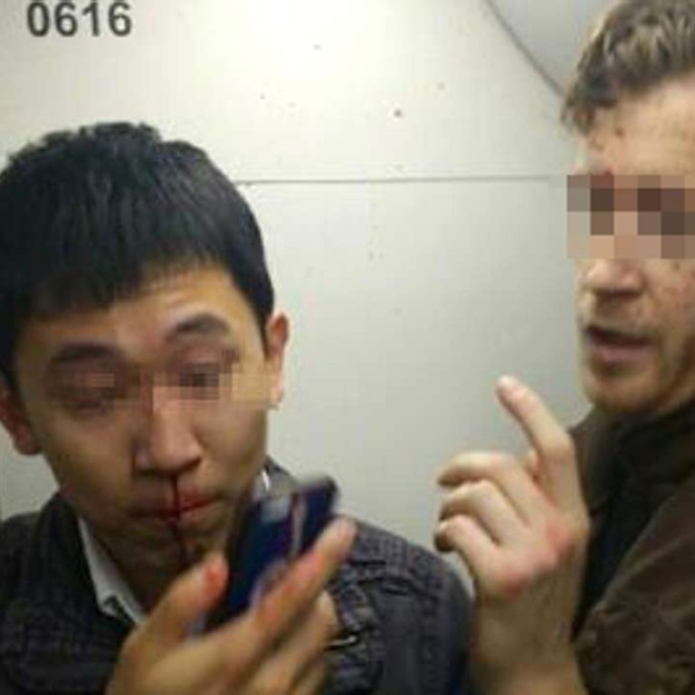 Chinese Man And Foreigner In Bloody Beijing Subway Brawl South