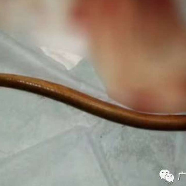 Eels Eel Girl Pussy Porn - anal baby eels - Eel - Wikipedia