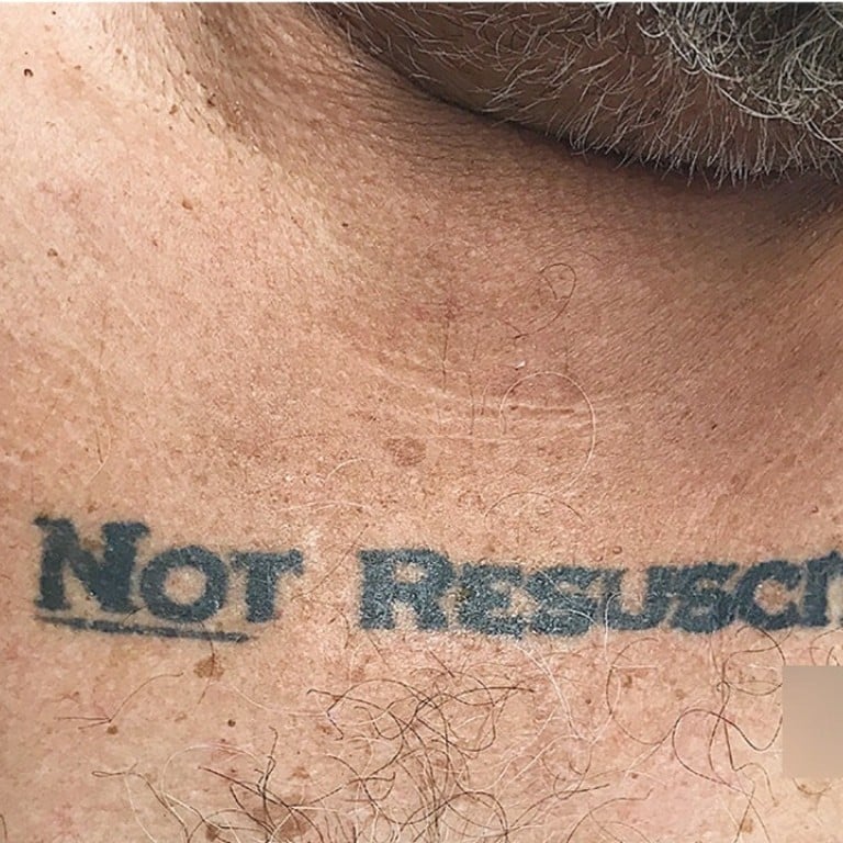 ‘Do not resuscitate’ unconscious patient’s tattoo thrust lifeanddeath ethical dilemma on