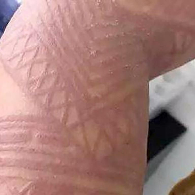 Bali Tourists Warned Fake Henna Tattoos Could Put Lives At Risk South China Morning Post