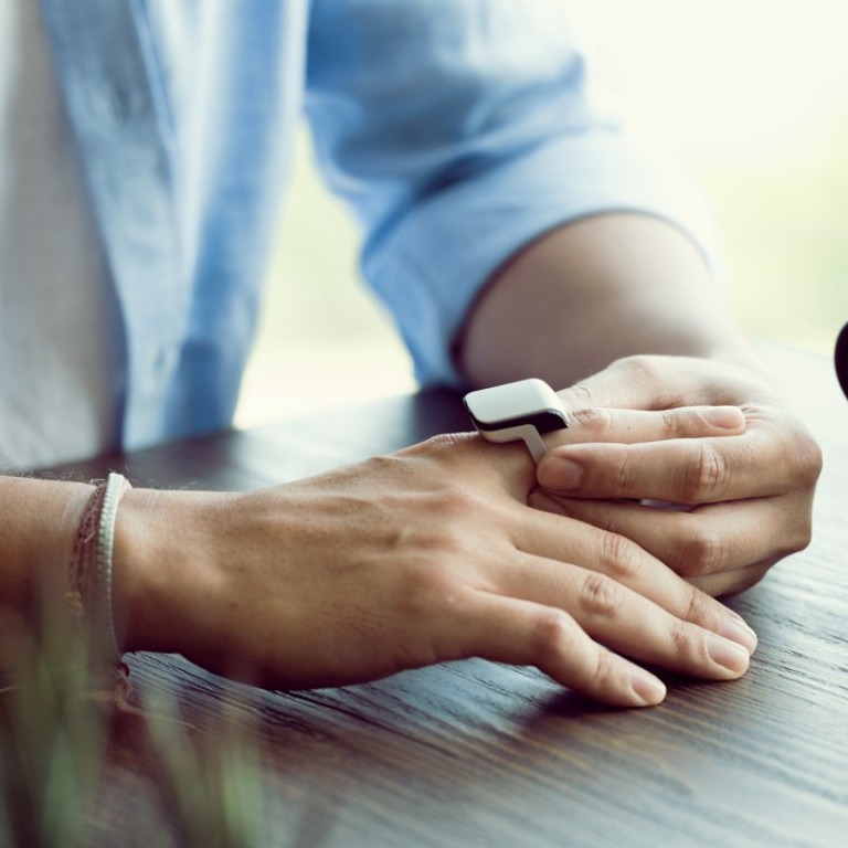 alternative to iwatch