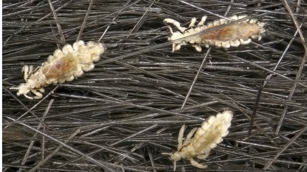 Nits a mother’s three failed attempts to root them out, and the head