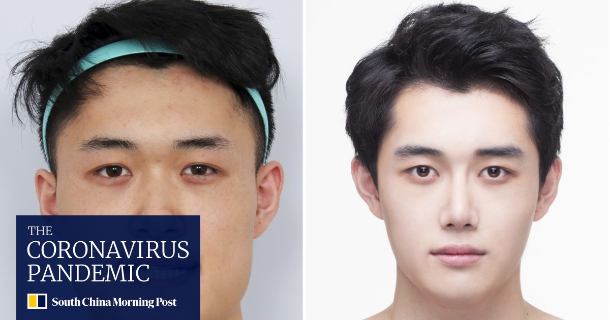 South Korean Men Having Plastic Surgery To Get Pretty Boy