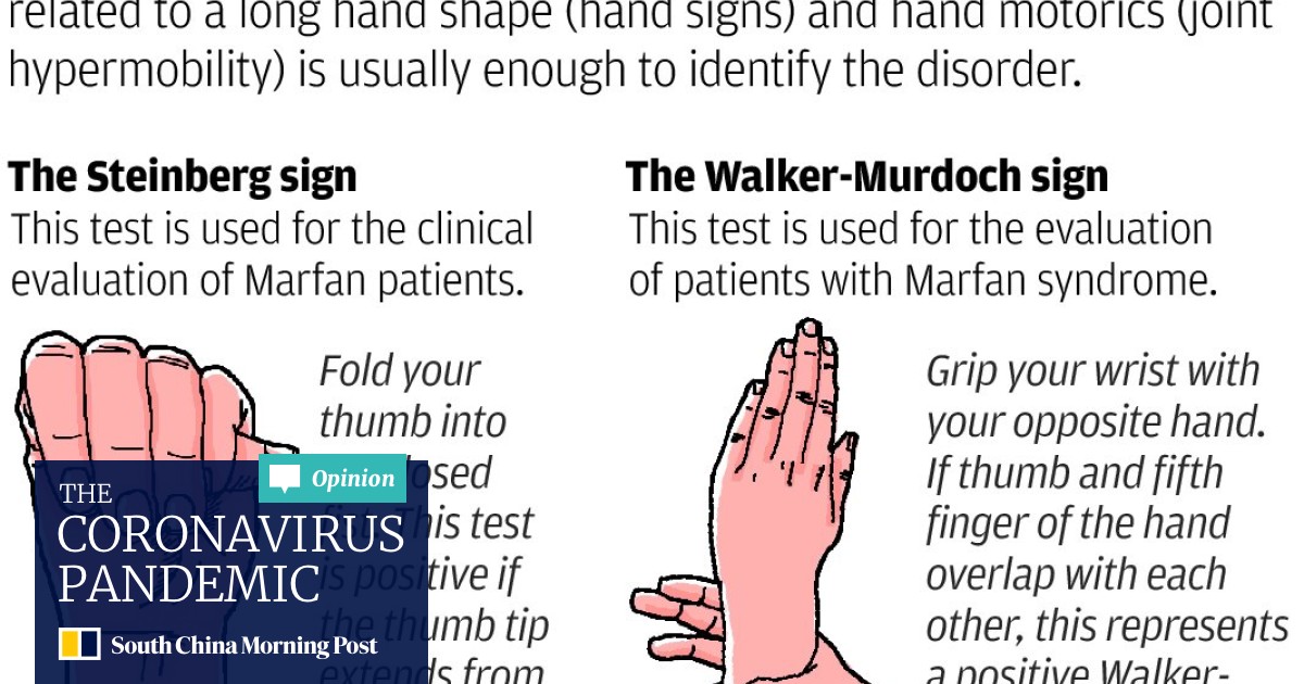 Lifelong Drug Therapy The Key To Coping With Marfan Syndrome South China Morning Post