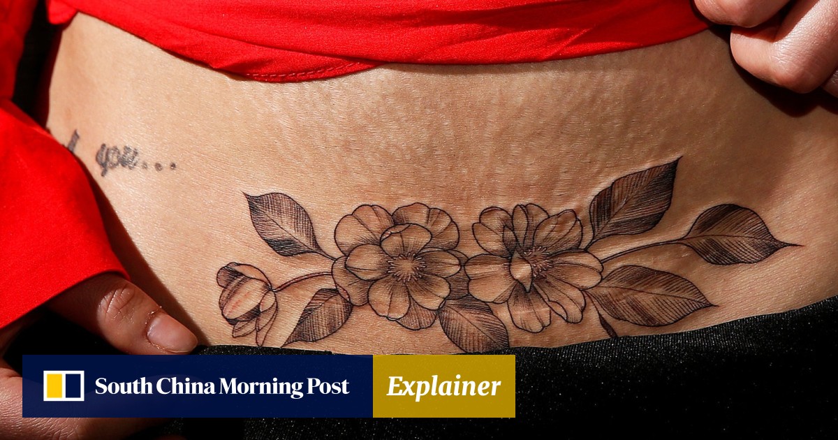 In Pictures Chinese Tattooist Offers Help To Cover Mums Birth
