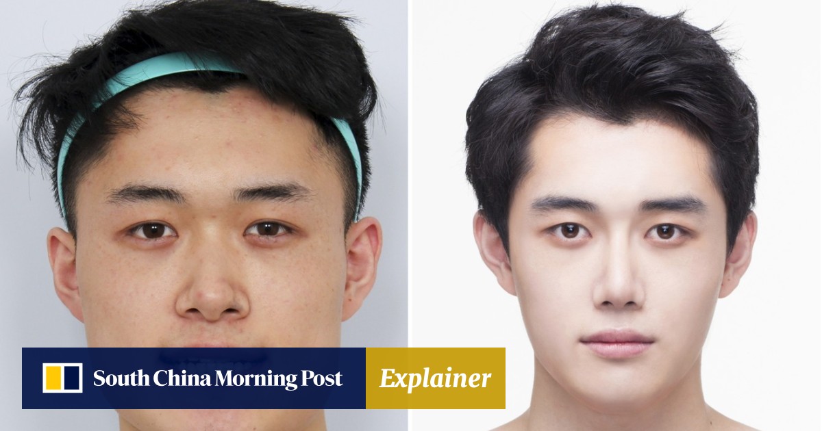 South Korean Men Having Plastic Surgery To Get Pretty Boy Looks