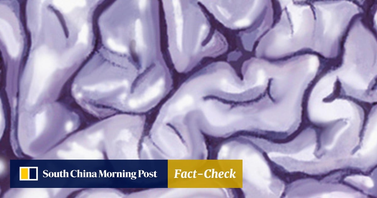 Scientist Says He Has Grown Tiny But Near Complete Human Brain In Lab South China Morning Post