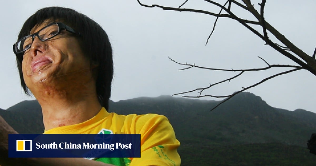 Amazing Survivor Of Hong Kong Fire Returns To Charred Home Image Photography