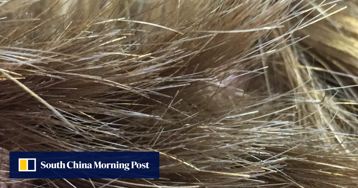 Is Cutting Your Hair The Only Way To Get Rid Of Split Ends