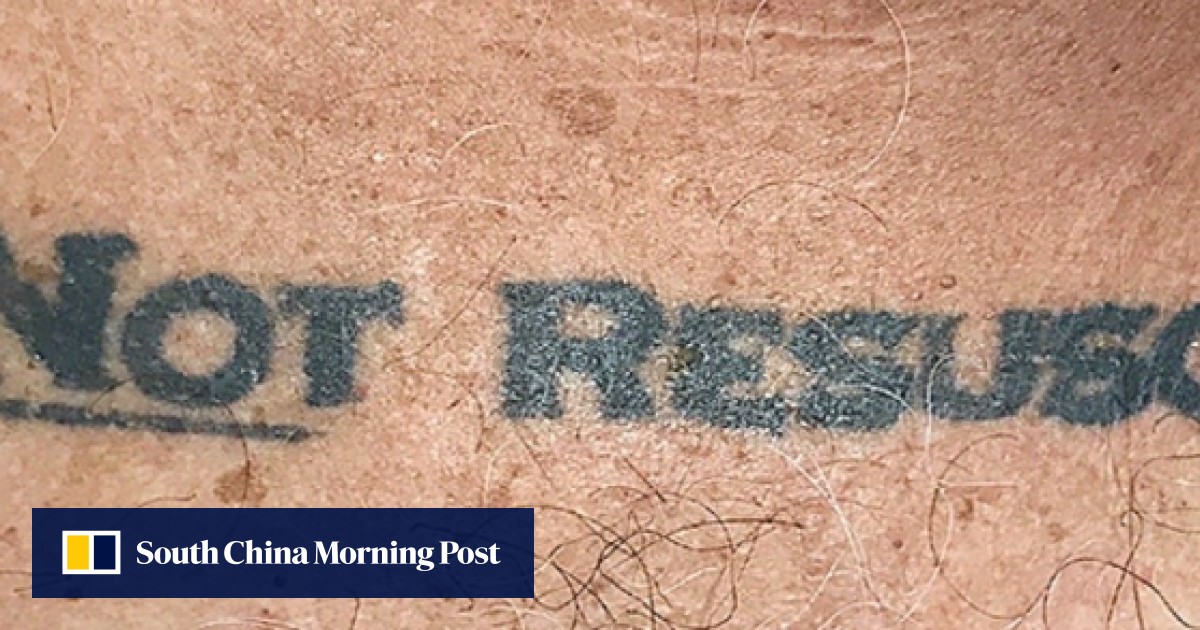 ‘Do not resuscitate’ unconscious patient’s tattoo thrust lifeanddeath ethical dilemma on