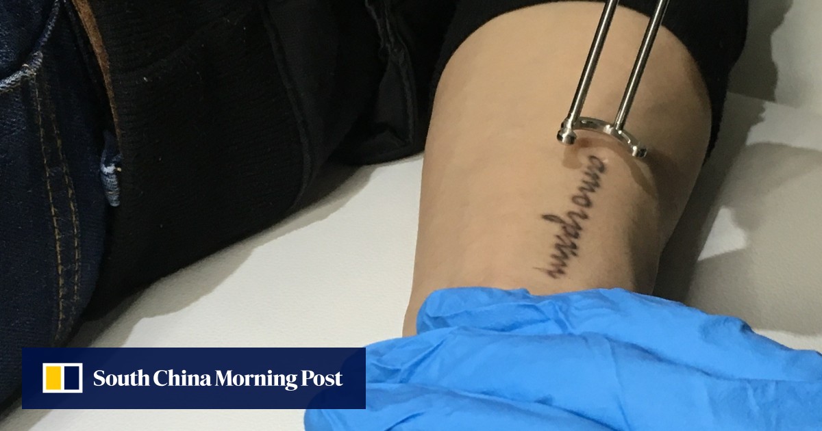 Why Laser Tattoo Removal Is On The Rise And Why You Should Think Twice Before Getting Inked In The First Place South China Morning Post