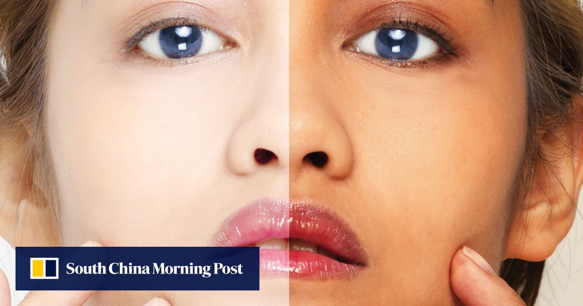 1200px x 630px - Asia's addiction to whiter skin runs deep â€“ but the backlash ...