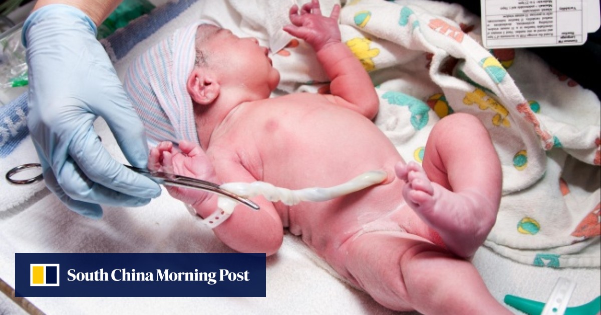 Cutting The Cord Too Soon Bad For Babies South China Morning Post