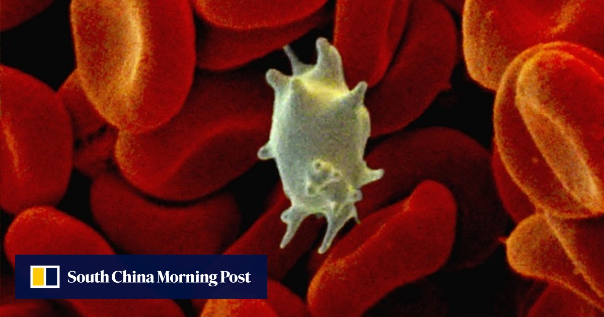 Those With A Low Platelet Count Benefit From A Healthy Diet South China Morning Post