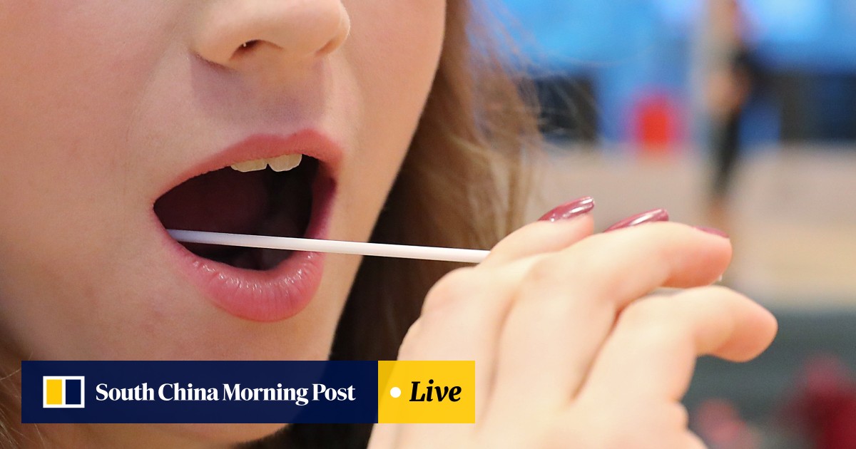 Us 600 Dna Test That Tells You How To Exercise And What To Eat Offered To Hong Kong Gym Goers We Give It A Try South China Morning Post