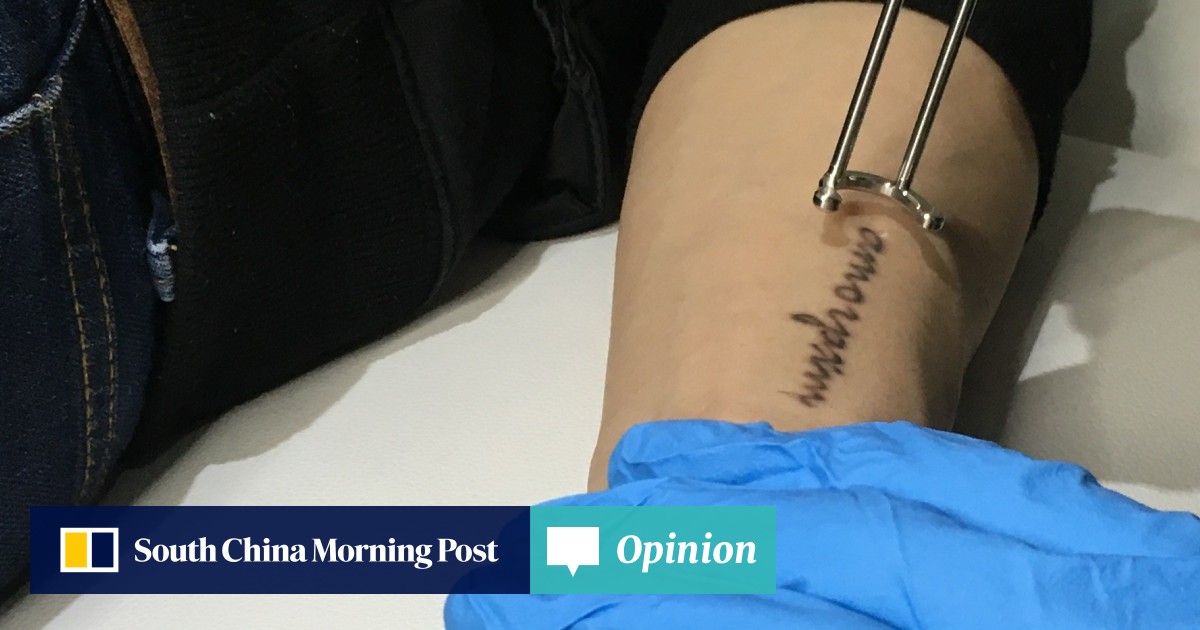 Why Laser Tattoo Removal Is On The Rise And Why You Should Think Twice Before Getting Inked In The First Place South China Morning Post